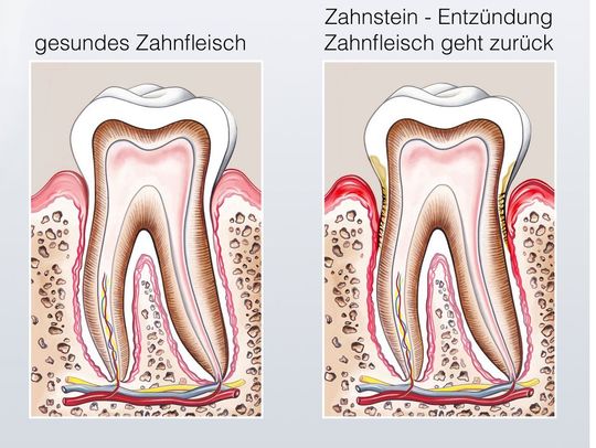 Parodontologie - Zahnarzt Dr. med. dent. Pastori - Bassersdorf